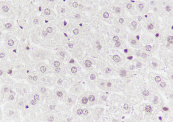 SBDS Recombinant Mouse Monoclonal Antibody