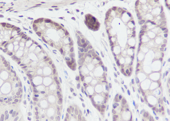 SBDS Recombinant Mouse Monoclonal Antibody
