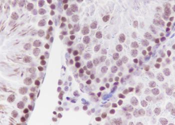 Mono-Methyl-Histone H3 (Lys4) Recombinant Mouse Monoclonal Antibody