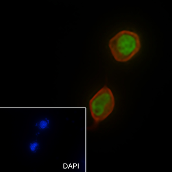 SF1 Recombinant Rabbit Monoclonal Antibody