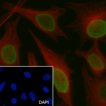 Di-Methyl-Histone H3 (Lys79) Recombinant Mouse Monoclonal Antibody
