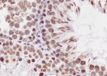Di-Methyl-Histone H3 (Lys79) Recombinant Mouse Monoclonal Antibody