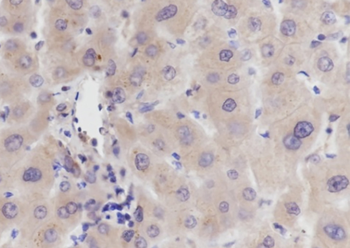 VPS18 Recombinant Mouse Monoclonal Antibody