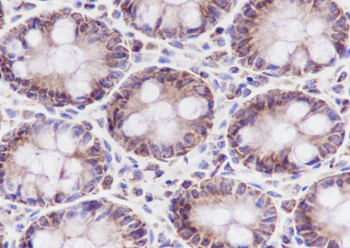 HSPE1 Recombinant Rabbit Monoclonal Antibody