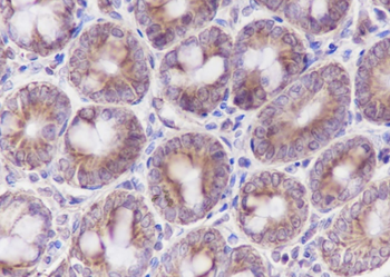 HSPE1 Recombinant Rabbit Monoclonal Antibody