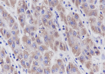 TOMM40 Recombinant Mouse Monoclonal Antibody