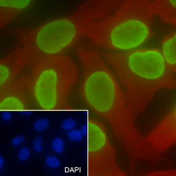 Di-Methyl-Histone H3 (Lys27) Recombinant Rabbit Monoclonal Antibody
