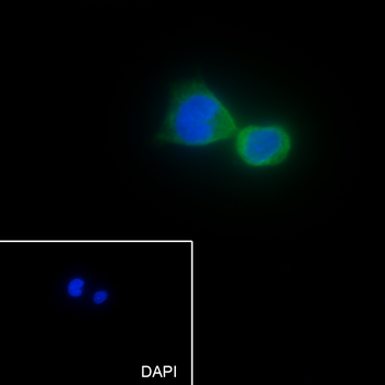 OGDH Recombinant Mouse Monoclonal Antibody