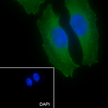 PHGDH Recombinant Mouse Monoclonal Antibody