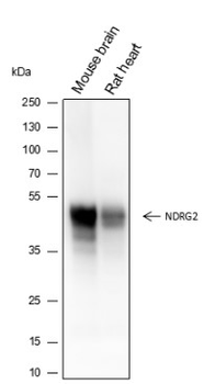 NDRG2 Recombinant Mouse Monoclonal Antibody