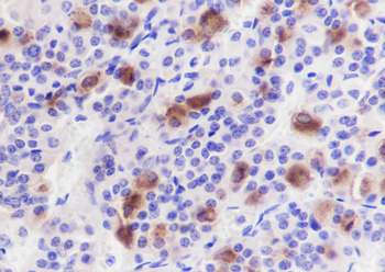 LHB Recombinant Rabbit Monoclonal Antibody