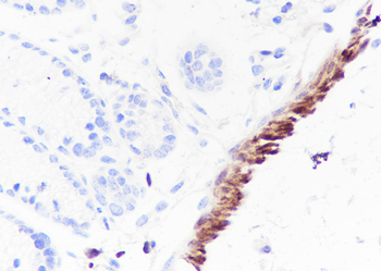 HSPB6 Recombinant Mouse Monoclonal Antibody