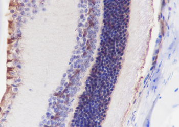 CRALBP Recombinant Rabbit Monoclonal Antibody
