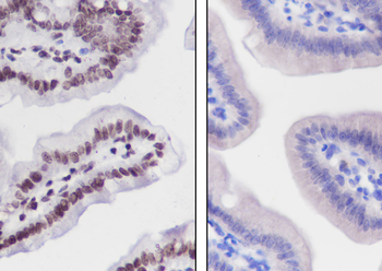 Crotonyl-Histone H2B (Lys11) Recombinant Rabbit Monoclonal Antibody