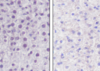 Crotonyl-Histone H2B (Lys11) Recombinant Rabbit Monoclonal Antibody
