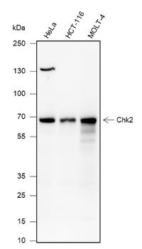CHEK2 Mouse Monoclonal Antibody