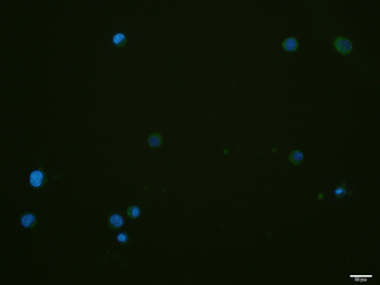 Human CD11a Mouse Monoclonal Antibody