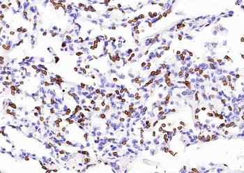 Human CD235a (GYPA) Mouse Monoclonal Antibody