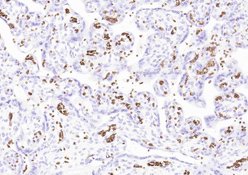Human CD235a (GYPA) Mouse Monoclonal Antibody
