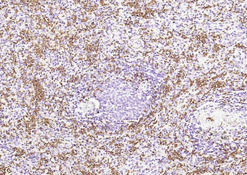 Human CD235a (GYPA) Mouse Monoclonal Antibody