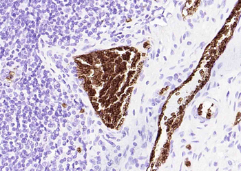 Human CD235a (GYPA) Mouse Monoclonal Antibody
