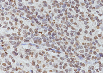 Di-Methyl-Histone H3 (Lys79) Mouse Monoclonal Antibody