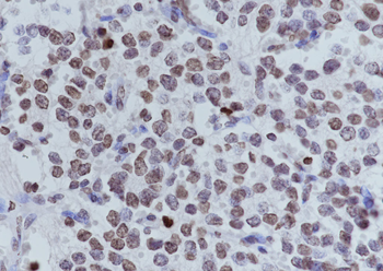 Di-Methyl-Histone H3 (Lys9) Mouse Monoclonal Antibody