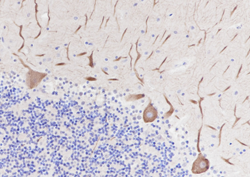 PAK3 Rabbit Polyclonal Antibody