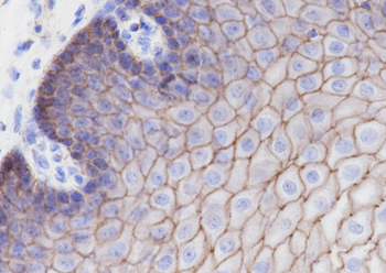 CTNND1 Recombinant Rabbit Monoclonal Antibody