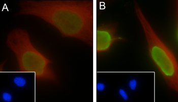 Acetyl-Histone H4 (Lys12) Mouse Monoclonal Antibody