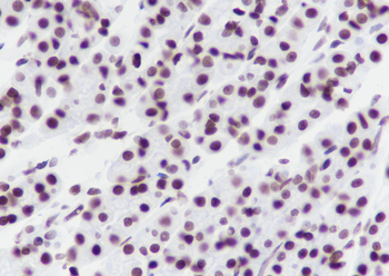 Acetyl-Histone H4 (Lys12) Mouse Monoclonal Antibody