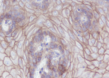 CLDN1 Recombinant Rabbit Monoclonal Antibody