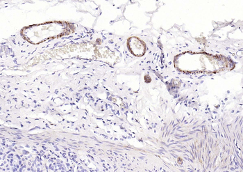 Pan Actin Recombinant Rabbit Monoclonal Antibody