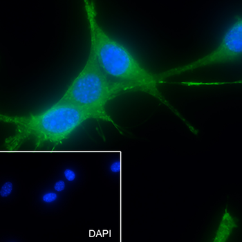 Pan Actin Recombinant Rabbit Monoclonal Antibody