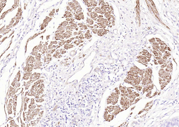 Pan Actin Recombinant Rabbit Monoclonal Antibody