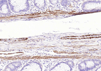 Pan Actin Recombinant Rabbit Monoclonal Antibody