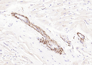 Pan Actin Recombinant Rabbit Monoclonal Antibody