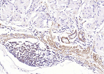 Pan Actin Recombinant Rabbit Monoclonal Antibody