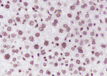 Di-Methyl-Histone H3 (Lys36) Mouse Monoclonal Antibody