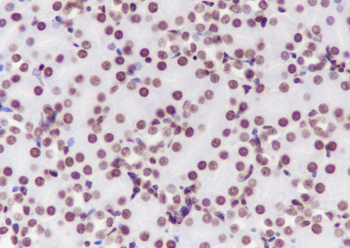 Di-Methyl-Histone H3 (Lys36) Mouse Monoclonal Antibody