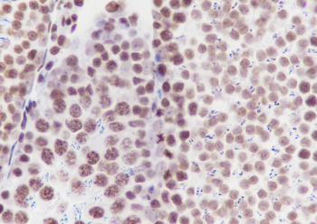 Di-Methyl-Histone H3 (Lys36) Mouse Monoclonal Antibody