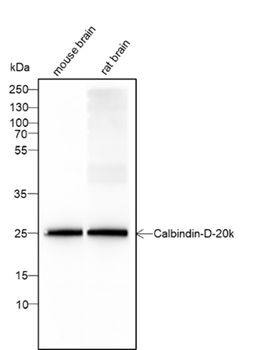 CALB1 Recombinant Mouse Monoclonal Antibody