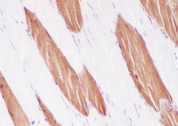Myosin light chain 3 Recombinant Rabbit Monoclonal Antibody