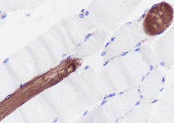 Myosin light chain 3 Recombinant Rabbit Monoclonal Antibody