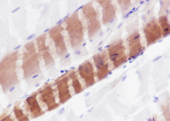 Myosin light chain 3 Recombinant Rabbit Monoclonal Antibody