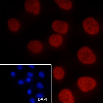 Di-Methyl-Histone H3 (Lys36) Rabbit Polyclonal Antibody