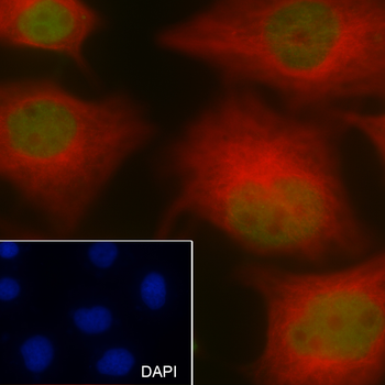 Acetyl-Histone H4 (Lys5) Mouse Monoclonal Antibody