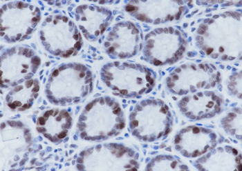 Acetyl-Histone H4 (Lys5) Mouse Monoclonal Antibody