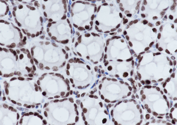 Tri-Methyl-Histone H3 (Lys27) Rabbit Polyclonal Antibody