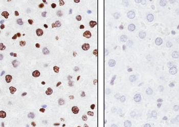 Malonyl-Histone H3 (Lys122) Recombinant Rabbit Monoclonal Antibody